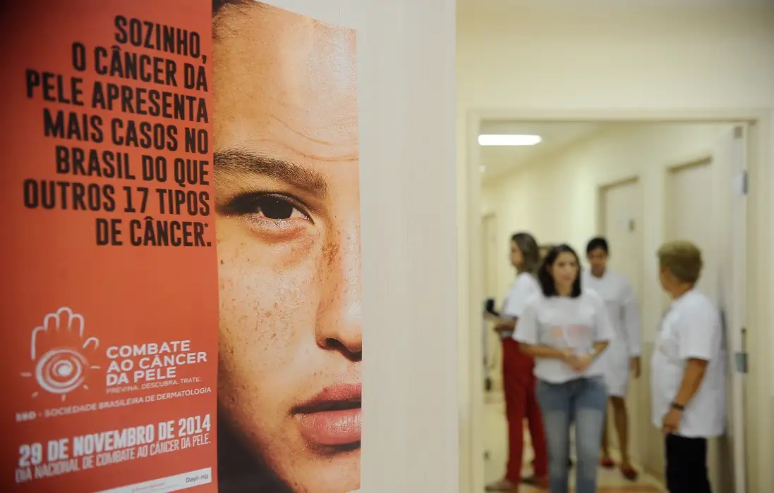 Casos de câncer de pele saltam de 4 mil para mais de 72 mil em 10 anos