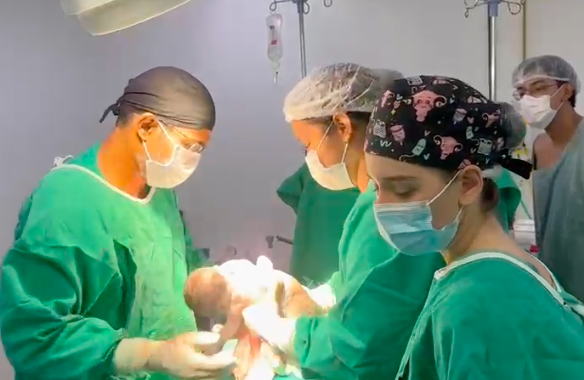 Hospital Estadual da Mulher realiza parto raro de gêmeos siameses em Goiânia