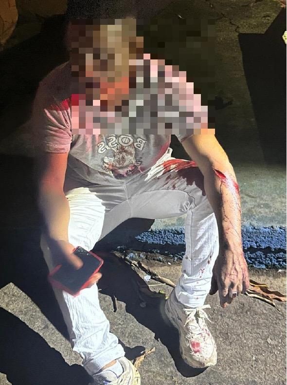 Guarda Civil prende homem que tentou matar vizinho após briga em Aparecida de Goiânia