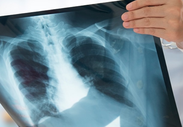 Prefeitura de Goiânia amplia e moderniza diagnóstico precoce de doenças pulmonares