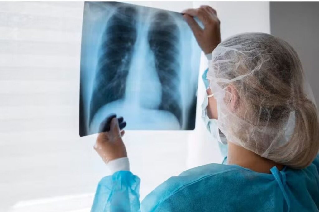 Hospitalizações por Influenza A têm aumentado no país, informa Fiocruz