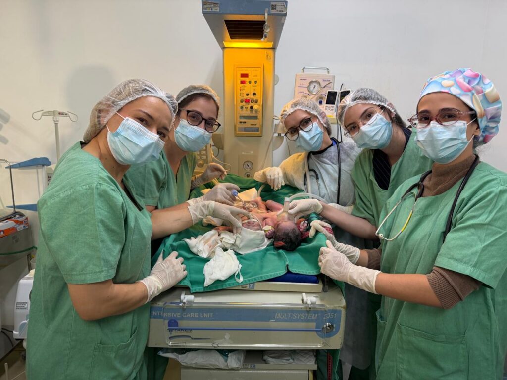 Siameses do Tocantins nascem em Goiânia e médicos apontam condições viáveis para separação