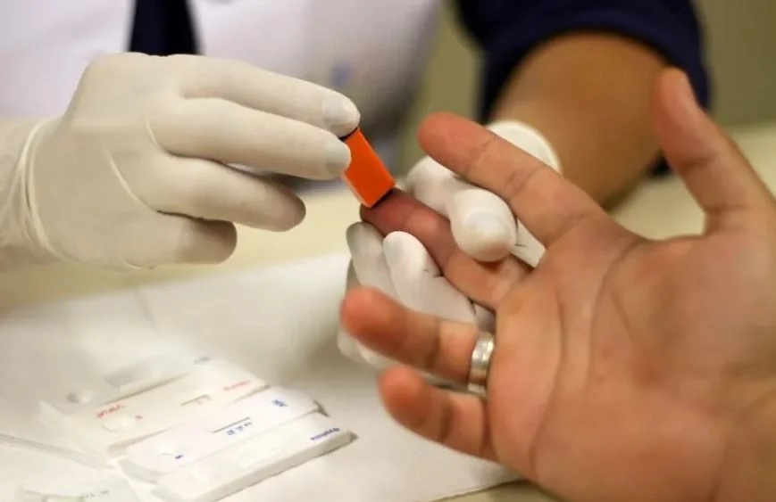 Número de novos casos de HIV cai em todo o mundo desde 2010, mas cresce no Brasil